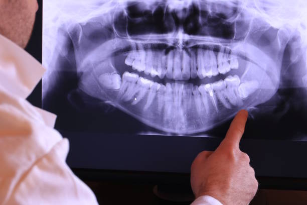 Best Emergency Dental Care for Broken or Chipped Teeth in Calumet Park, IL